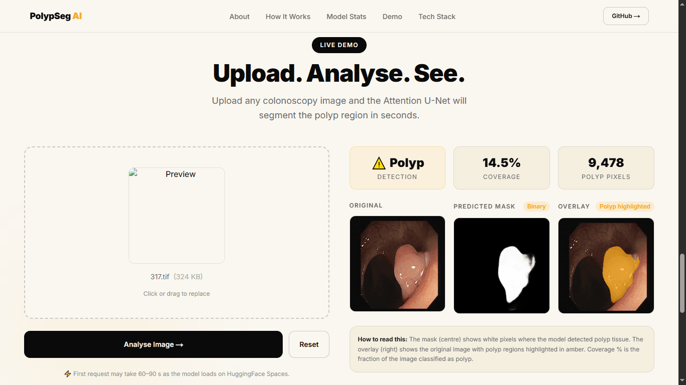 PolypSeg — Medical Imaging Full Stack
