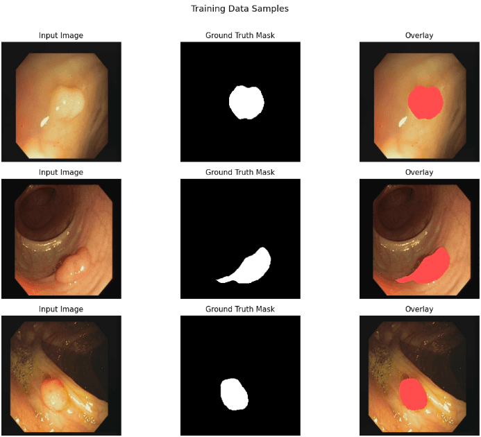 Polyp Image Segmentation — Attention U-Net